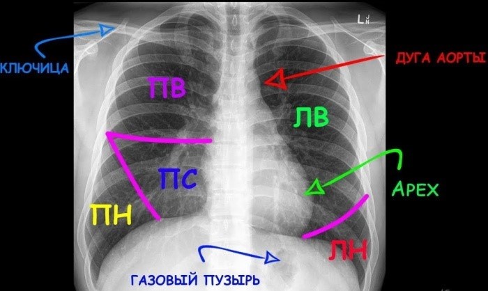 Процедура получения флюорографии вне места прописки