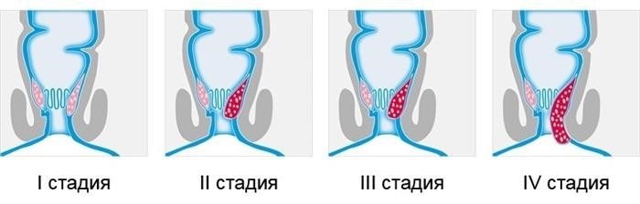 Как записаться на прием к проктологу в военкомате?